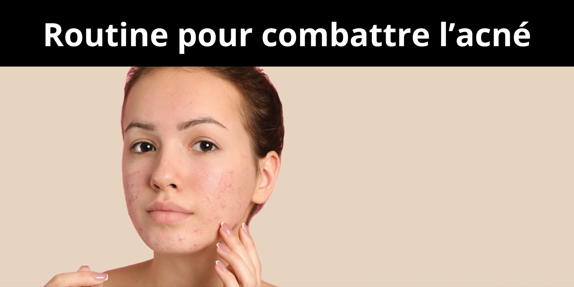 Routine pour combattre l’acné
