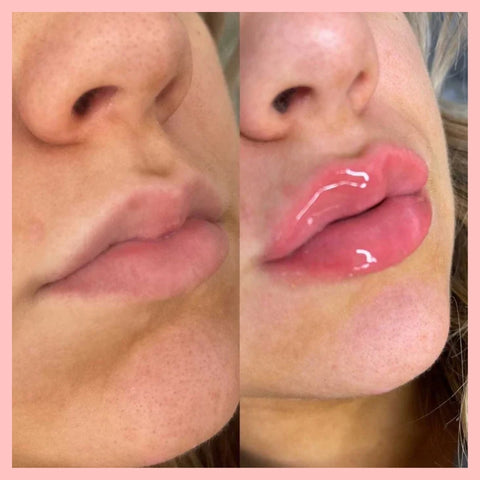 VOLULIPS Lip Plumper Immediate Effect