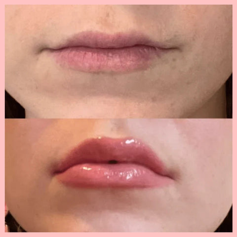 VOLULIPS Lip Plumper Immediate Effect