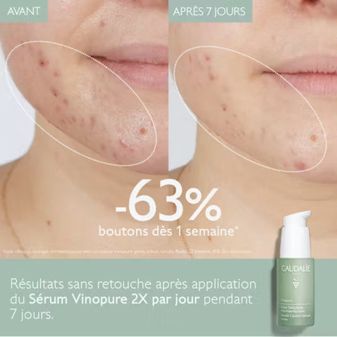 CAUDALIE Vinopure Sérum Acide Salicylique Anti-imperfections 30ml