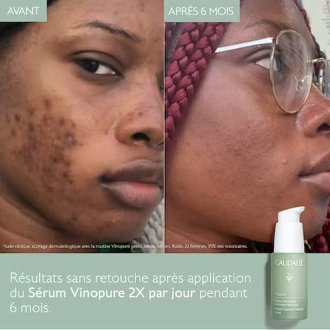 CAUDALIE Vinopure Sérum Acide Salicylique Anti-imperfections 30ml