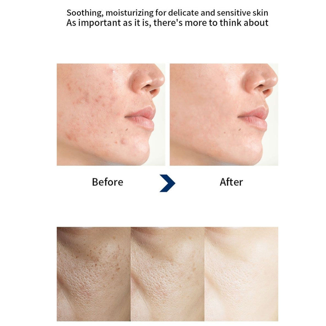 WHA’ YUNSUL Centella Asiatica Calming Ampoule Serum 